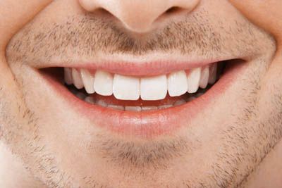 closeup of a Napa Valley Dental Group patient's smile